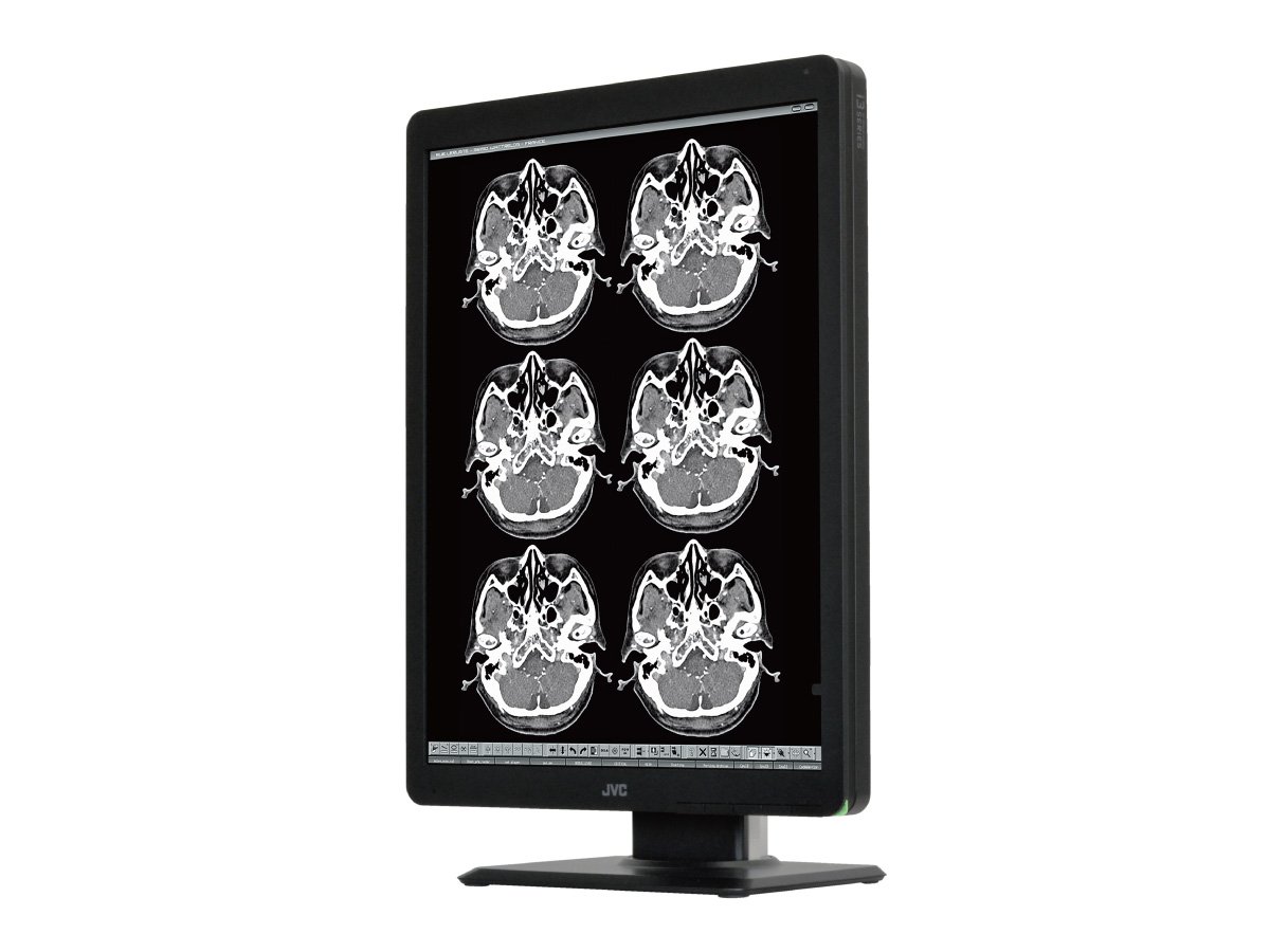 200万画素21.3型モノクローム液晶モニターMS-S200 | 医用モニター